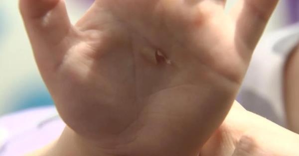 新西兰基督城幼儿园滑梯惊现危险物质，多名儿童惨遭化学灼伤！