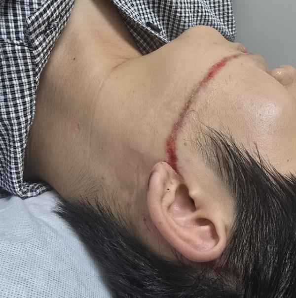 夏日狂欢节水枪伤人事件，主办方被立案追责